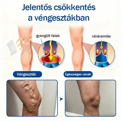 💚Medistart® Visszérápoló Mikrotűs Gondozó Tapasz ⚡ Azonnali Megkönnyebbülés, Hosszú Távú Eredmények