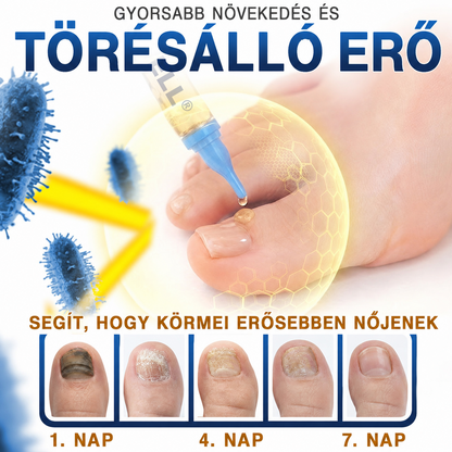 🎁💅Már csak 5 doboz maradt. Extra 50% kedvezményt biztosítunk! Tartsa meg egészségét és alakját. Ha most lemarad, jövőre már nem lesz rá lehetősége!