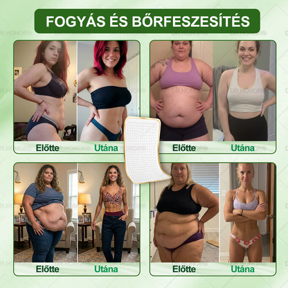 🌱【2026 Továbbfejlesztett Verzió｜-80% Kedvezmény】𝐃𝐑.𝐇𝐎𝐍𝐎𝐑® Nyirokdrenázs Nano-Mikrotűs Tapasz 🔥 5× erősebb formula Támogatja a zsírégetést, a nyirokkeringést, az ízületi komfortot és a pihentető alvást.
