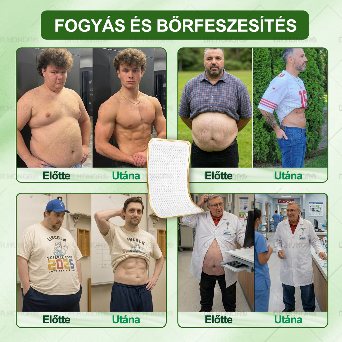 🌱【2026 Továbbfejlesztett Verzió｜-80% Kedvezmény】𝐃𝐑.𝐇𝐎𝐍𝐎𝐑® Nyirokdrenázs Nano-Mikrotűs Tapasz 🔥 5× erősebb formula Támogatja a zsírégetést, a nyirokkeringést, az ízületi komfortot és a pihentető alvást.