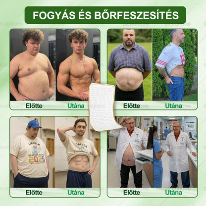 🌱【2026 Továbbfejlesztett Verzió｜-80% Kedvezmény】𝐃𝐑.𝐇𝐎𝐍𝐎𝐑® Nyirokdrenázs Nano-Mikrotűs Tapasz 🔥 5× erősebb formula Támogatja a zsírégetést, a nyirokkeringést, az ízületi komfortot és a pihentető alvást.