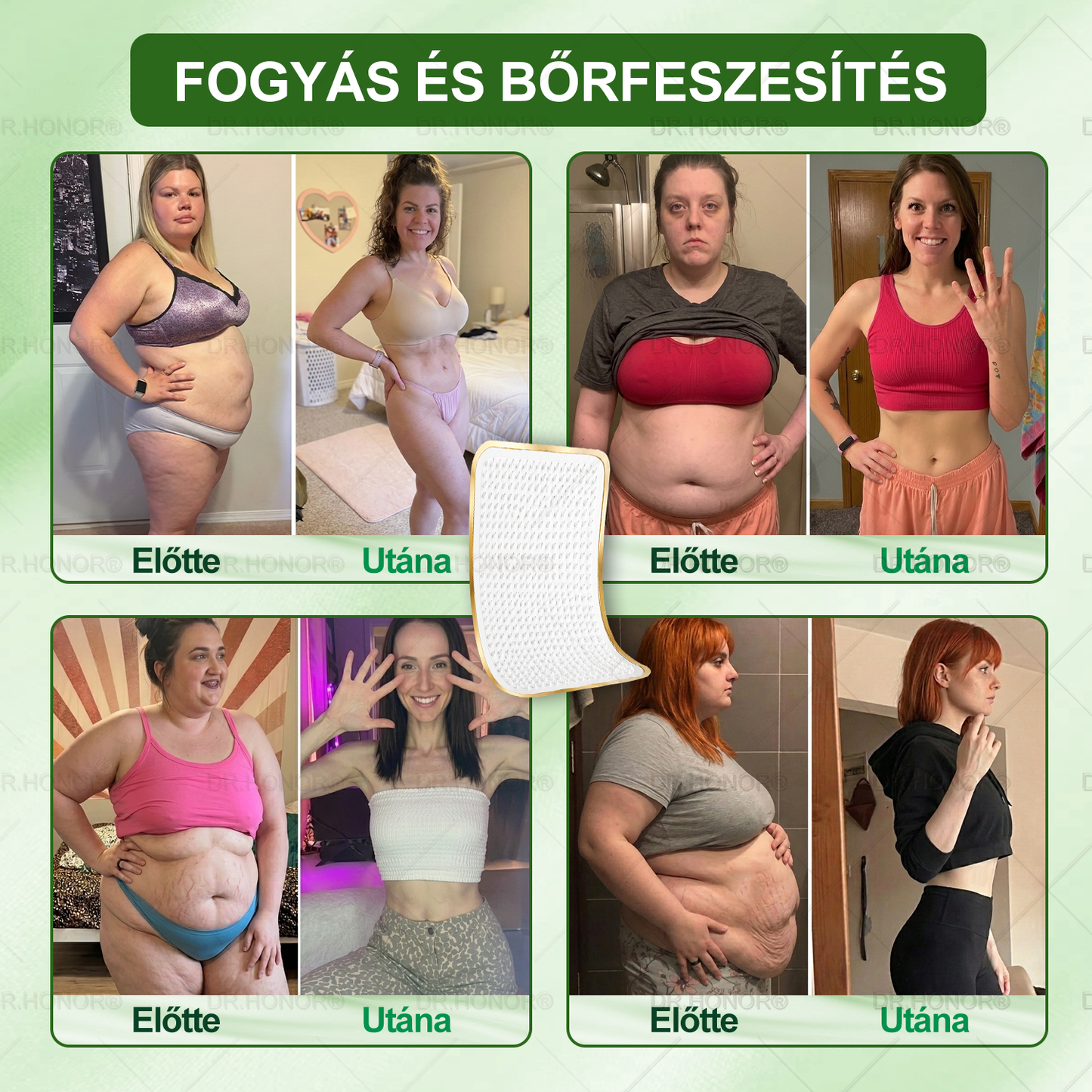 🌱【2026 Továbbfejlesztett Verzió｜-80% Kedvezmény】𝐃𝐑.𝐇𝐎𝐍𝐎𝐑® Nyirokdrenázs Nano-Mikrotűs Tapasz 🔥 5× erősebb formula Támogatja a zsírégetést, a nyirokkeringést, az ízületi komfortot és a pihentető alvást.