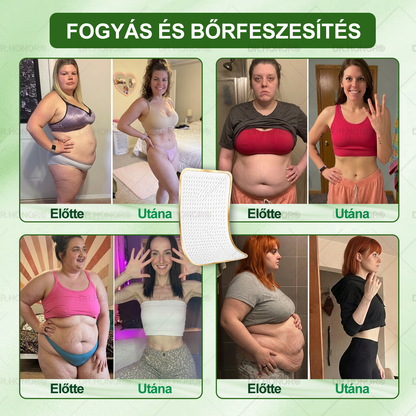 🌱【2026 Továbbfejlesztett Verzió｜-80% Kedvezmény】𝐃𝐑.𝐇𝐎𝐍𝐎𝐑® Nyirokdrenázs Nano-Mikrotűs Tapasz 🔥 5× erősebb formula Támogatja a zsírégetést, a nyirokkeringést, az ízületi komfortot és a pihentető alvást.