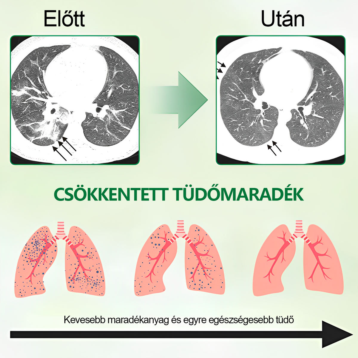 🌱BSWELL®  Fejlett Tüdőtisztító Spray -Támogatja a tüdő, a hörgők és az orrmelléküregek egészségét, elősegíti a légzőrendszer egészségét és a könnyebb légzést
