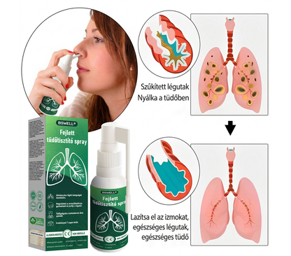 🌱BSWELL®  Fejlett Tüdőtisztító Spray -Támogatja a tüdő, a hörgők és az orrmelléküregek egészségét, elősegíti a légzőrendszer egészségét és a könnyebb légzést