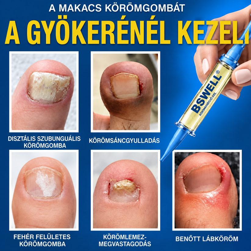 🎁💅Már csak 5 doboz maradt. Extra 50% kedvezményt biztosítunk! Tartsa meg egészségét és alakját. Ha most lemarad, jövőre már nem lesz rá lehetősége!