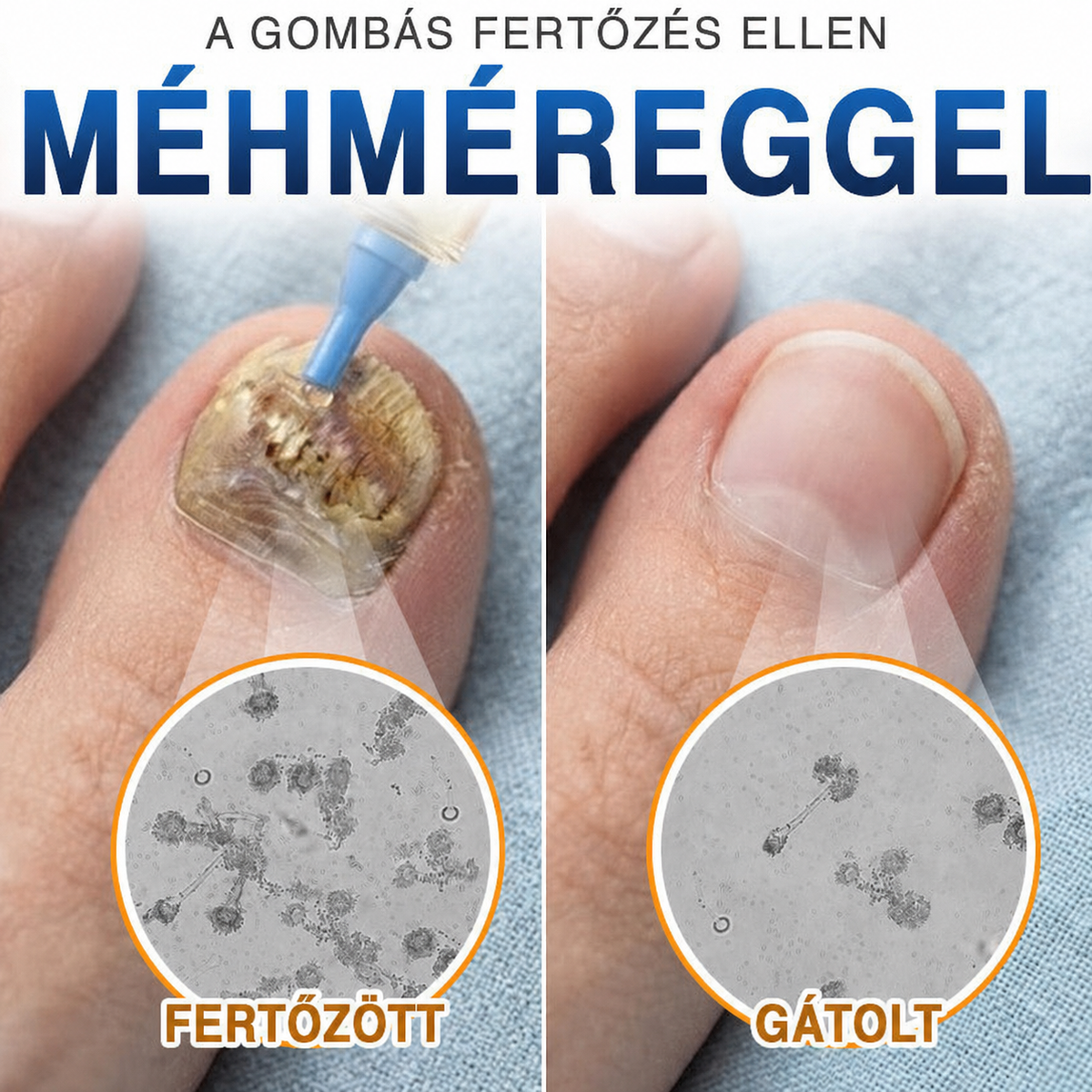 🎁💅Már csak 5 doboz maradt. Extra 50% kedvezményt biztosítunk! Tartsa meg egészségét és alakját. Ha most lemarad, jövőre már nem lesz rá lehetősége!